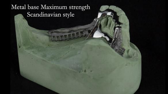 Ken – going downhill, first class