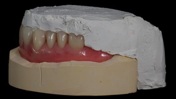 Newsletter 79 – Creating a wonderful smile and changing a life.