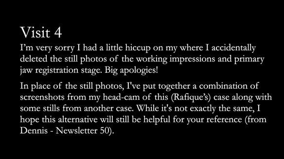 Finlay's Newsletter 62 provision of extractions and metal based complete dentures for Rafique