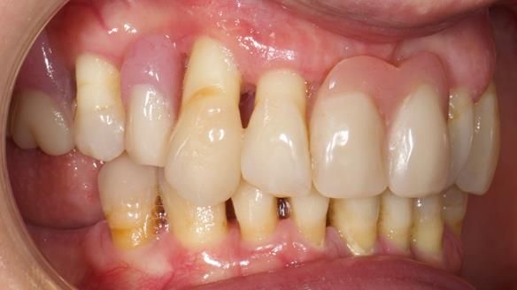 Newsletter 79 – Creating a wonderful smile and changing a life.