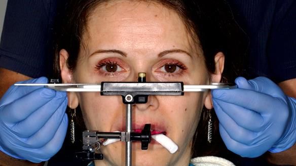 Newsletter 79 – Creating a wonderful smile and changing a life.