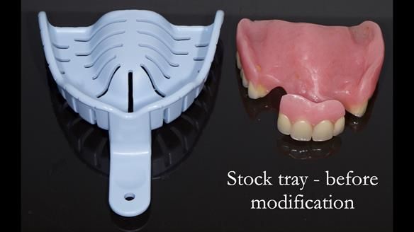 Finlay's Newsletter 59 Ultra hard partial dentures made for Gill