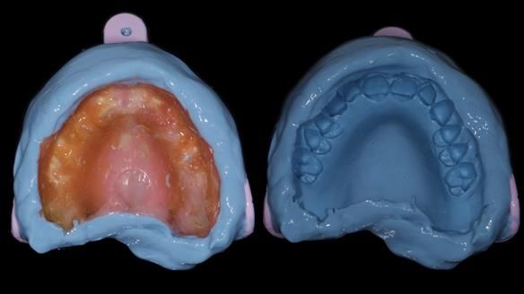 Newsletter 79 – Creating a wonderful smile and changing a life.