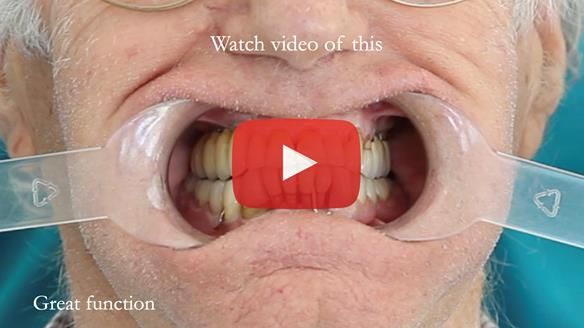 Ken – going downhill, first class