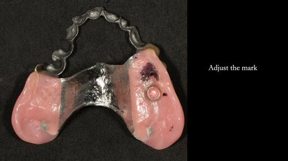 Ken – going downhill, first class