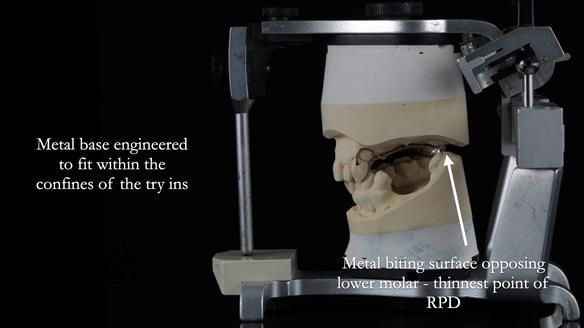 Finlay's Newsletter 60 Sylvia's upper Kennedy Class 2 Mod 1 metal based upper RPD