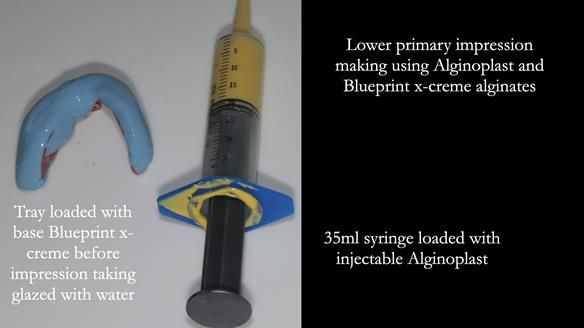 Newsletter 82 Mary - A complete upper and a one-tooth gasket denture