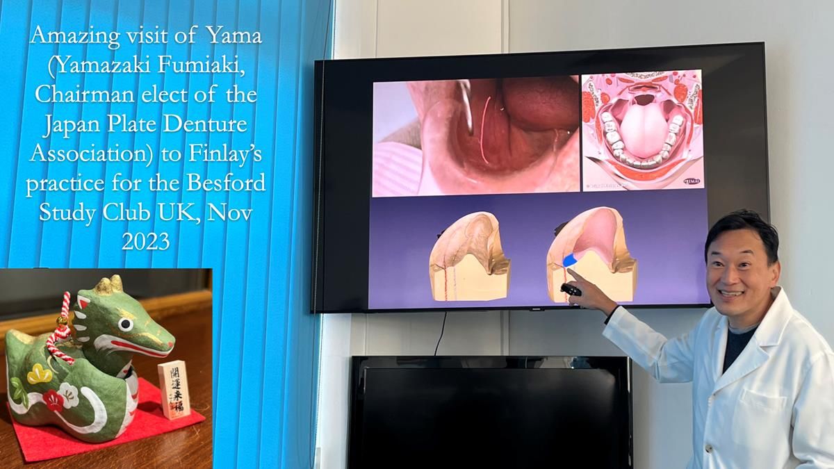 Finlay's Newsletter 59 Ultra hard partial dentures made for Gill