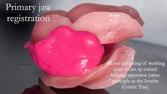 Finlay's Newsletter 62 provision of extractions and metal based complete dentures for Rafique