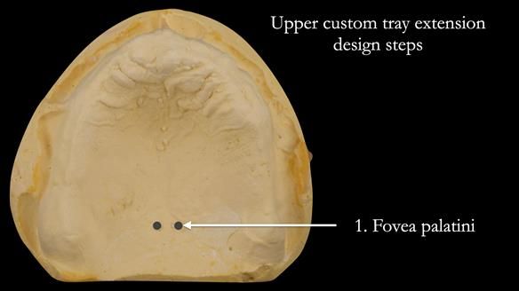 Newsletter 50 Special edition Complete Dentures FULL PROTOCOL
