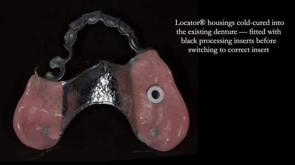 Ken – going downhill, first class