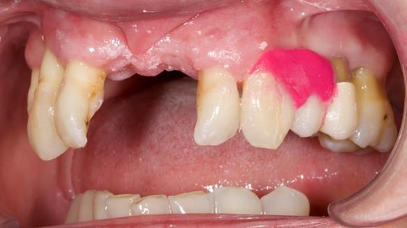 Newsletter 79 – Creating a wonderful smile and changing a life.