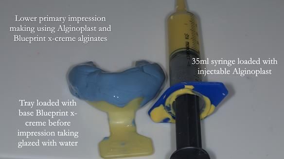 Newsletter 83: Sheila’s Complete Denture Success