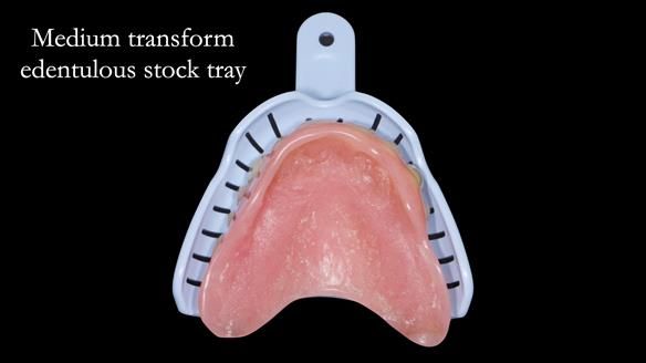 Newsletter 54 case presentation upper complete denture and lower Scandinavian designed hygienic partial denture for David