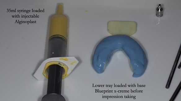 Newsletter 78: What do Clark Gable and a Locator® overdenture have in common?