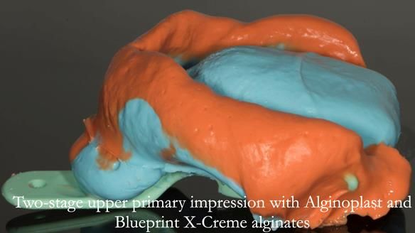 Newsletter 75: Marion’s case - Step-by-step complete denture workflow