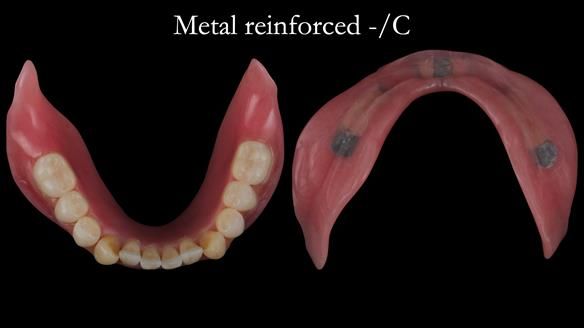 Newsletter 50 Special edition Complete Dentures FULL PROTOCOL