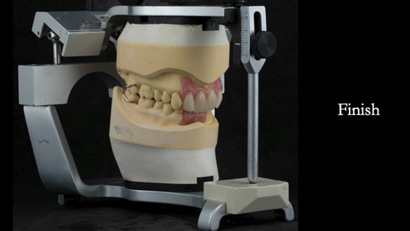 Figure 71 Finished definitive partial dentures