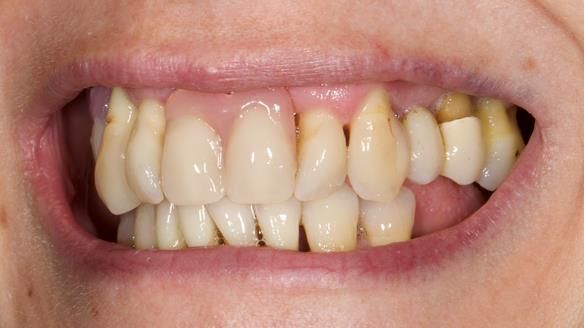 Newsletter 79 – Creating a wonderful smile and changing a life.