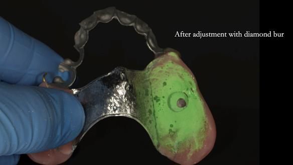 Ken – going downhill, first class