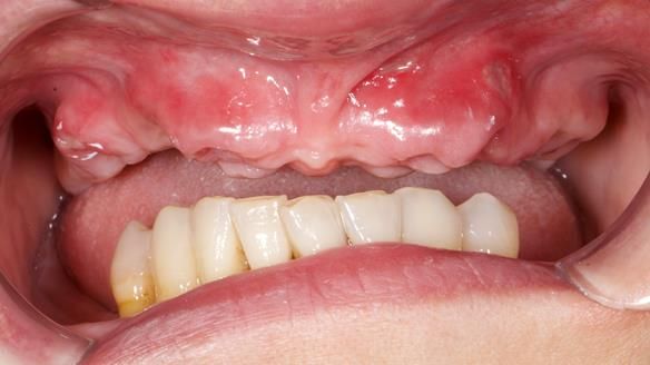 Newsletter 79 – Creating a wonderful smile and changing a life.