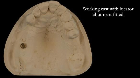 Ken – going downhill, first class