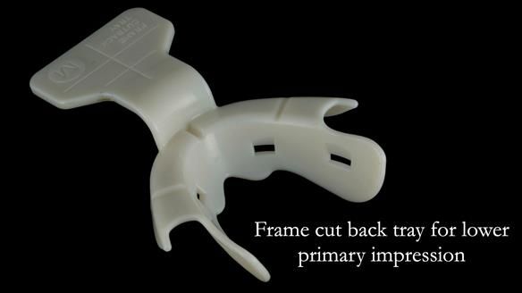 Newsletter 83: Sheila’s Complete Denture Success