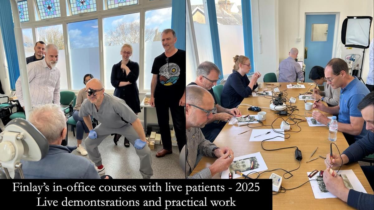 Newsletter 76: Jackie’s case – Telescopic overdenture & precision RPD (the tricky truth!)