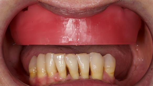 Newsletter 79 – Creating a wonderful smile and changing a life.