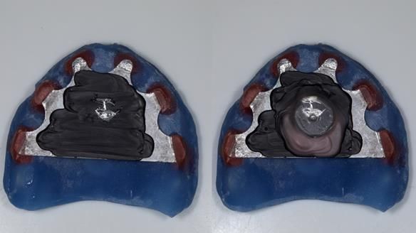 Newsletter 79 – Creating a wonderful smile and changing a life.