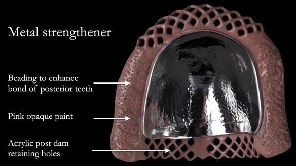 Newsletter 50 Special edition Complete Dentures FULL PROTOCOL