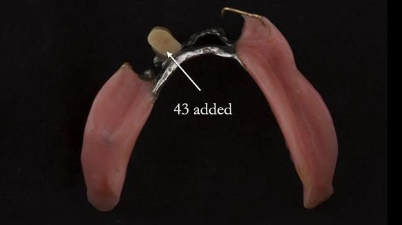 Ken – going downhill, first class