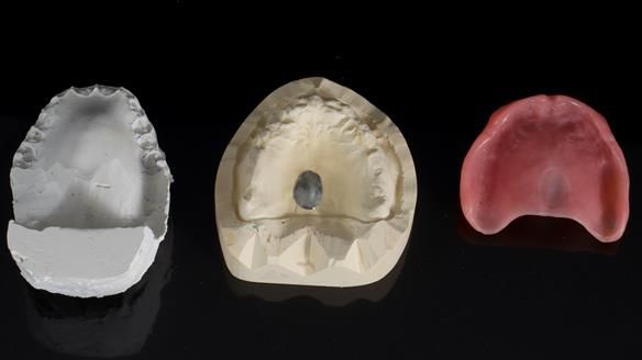 Newsletter 79 – Creating a wonderful smile and changing a life.