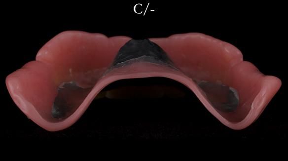 Newsletter 50 Special edition Complete Dentures FULL PROTOCOL