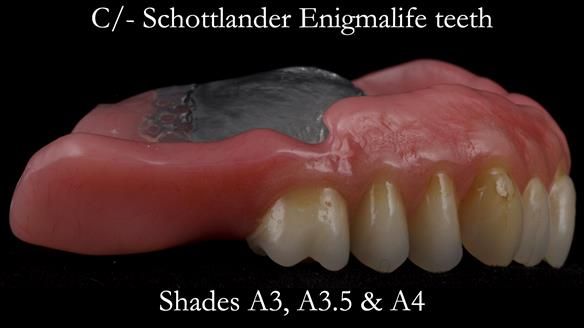 Newsletter 50 Special edition Complete Dentures FULL PROTOCOL