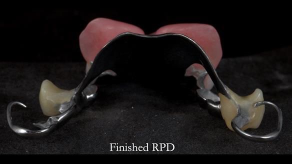 Newsletter 81 - Pam’s Story — how a partial denture changed her life (+ live walkthrough this Thursday)