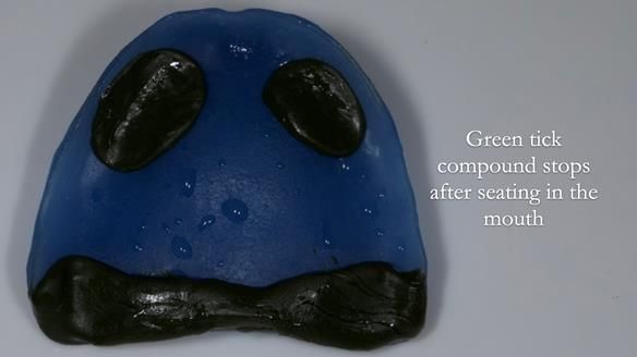 Newsletter 83: Sheila’s Complete Denture Success