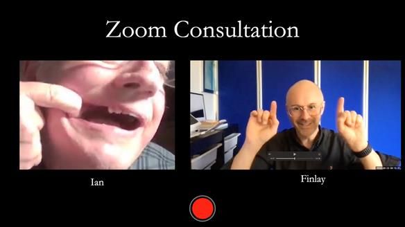 Finlay's Newsletter 64 case study - provision of a Kennedy class 2 metal based Scandinavian RPD for Ian