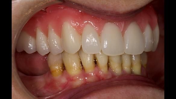 Newsletter 79 – Creating a wonderful smile and changing a life.