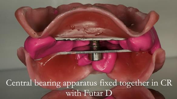 The central bearing apparatus out of the mouth fixed solidly together