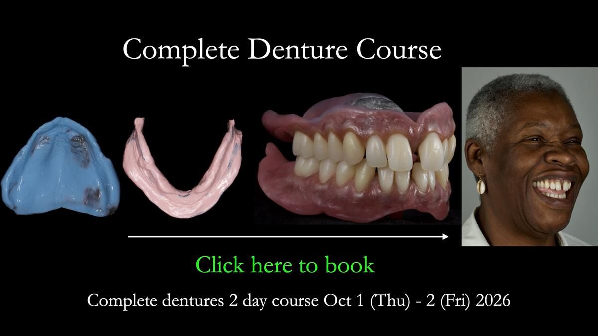Newsletter 86 Peter the Architect — precision removable partial dentures case study