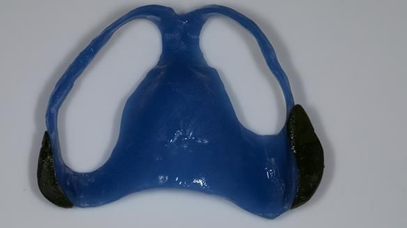 Newsletter 79 – Creating a wonderful smile and changing a life.