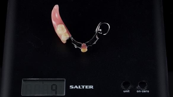 Newsletter 54 case presentation upper complete denture and lower Scandinavian designed hygienic partial denture for David