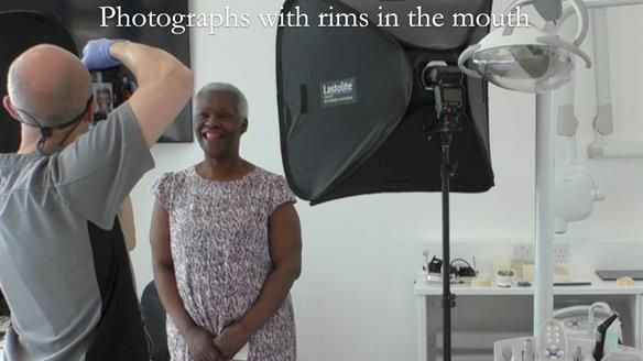 Newsletter 53 showing the making and fitting of ultra life-like dentures for Valena