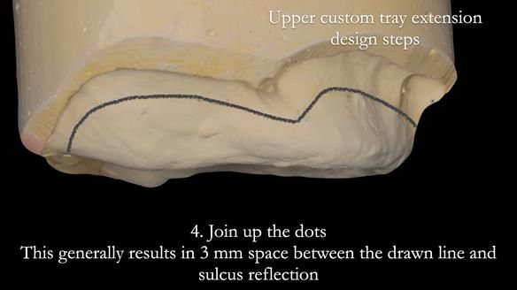 Newsletter 50 Special edition Complete Dentures FULL PROTOCOL