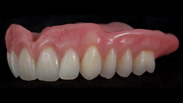 Newsletter 79 – Creating a wonderful smile and changing a life.