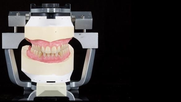 Newsletter 80 - Gordon’s dentures: the one case in 1,000 where my technique failed