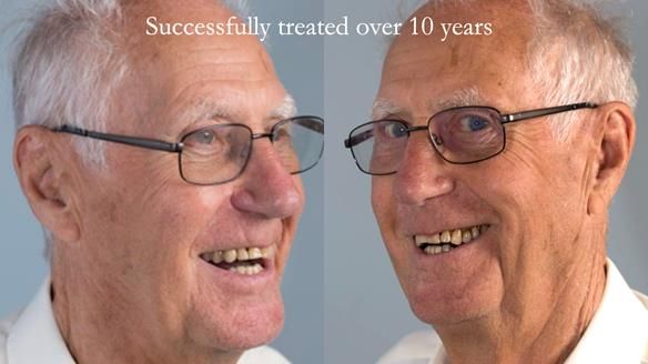 Ken – going downhill, first class