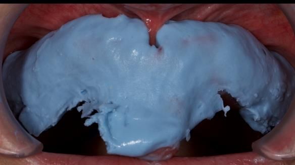 Newsletter 79 – Creating a wonderful smile and changing a life.