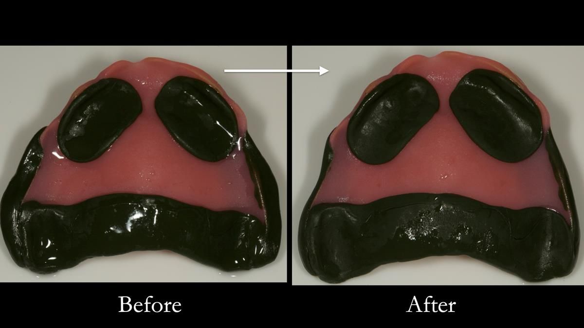 Newsletter 87 – Father Peter: A Partial Denture that needed Minor Miracle